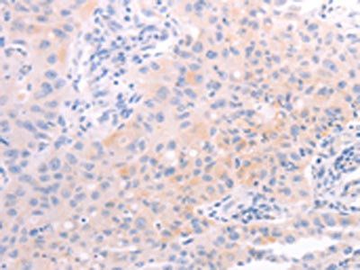 AMH Antibody
