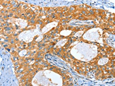AMHR2 Antibody