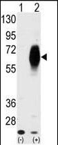 AMHR2 antibody