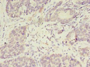 AMIGO2 Antibody