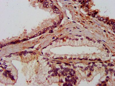 AMIGO2 Antibody