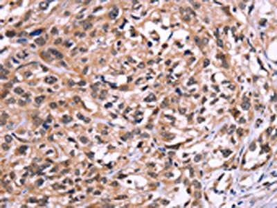 AMIGO2 Antibody