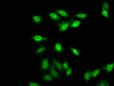 AMMECR1 antibody