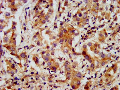 AMMECR1 Antibody