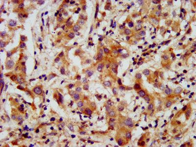 AMMECR1 antibody