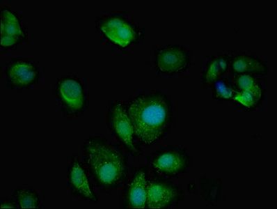 AMPD2 Antibody