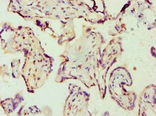 AMPD3 Antibody