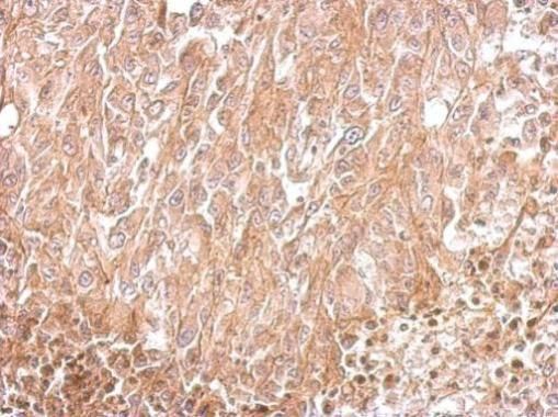 Amphiphysin antibody [N1N2], N-term