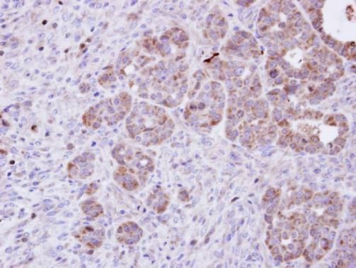Amphiphysin antibody [N1N2], N-term