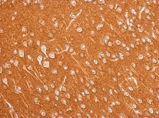 Amphiphysin antibody [N1N2], N-term