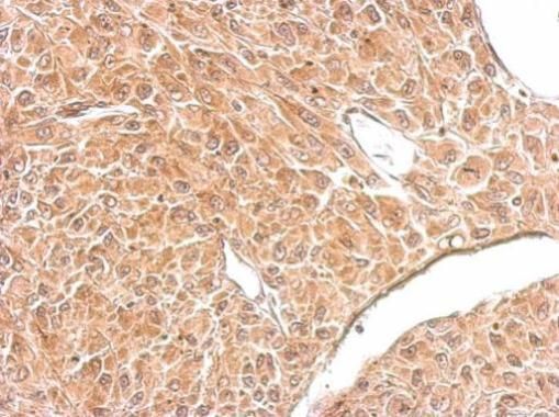 Amphiphysin antibody [N1N2], N-term
