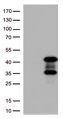 AMPK beta 1 Antibody