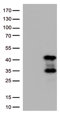 AMPK beta 1 Antibody
