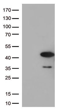 AMPK beta 1 Antibody