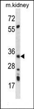 AMPK beta2 antibody