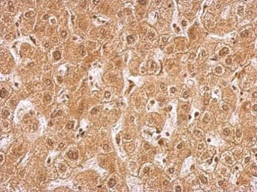 AMPK gamma 2 antibody [C2C3], C-term