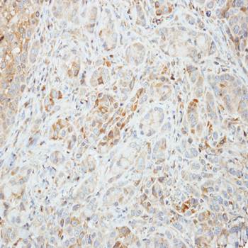 AMPK alpha 2 antibody