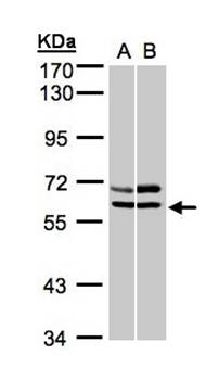 AMPK alpha 2 antibody