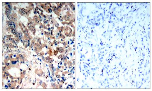 AMPKα1/AMPKα2(Phospho-Thr183/Thr172) Antibody