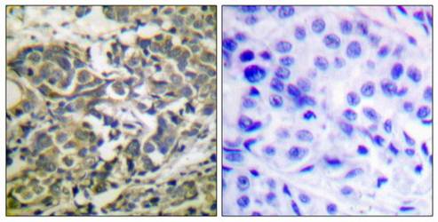 AMPKα (Phospho-Thr172) Antibody
