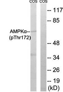 AMPKα (Phospho-Thr172) Antibody