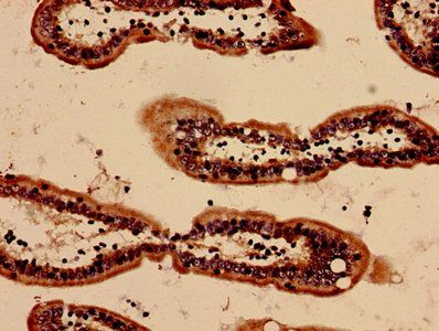 SAA1 Antibody