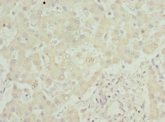 amyloid A-1 protein antibody