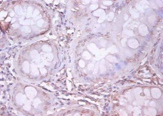 APP Antibody