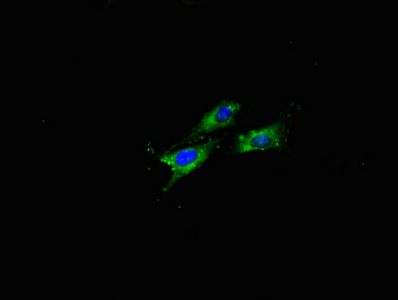 Amyloid beta A4 protein antibody