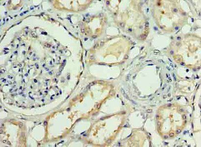 APP Antibody