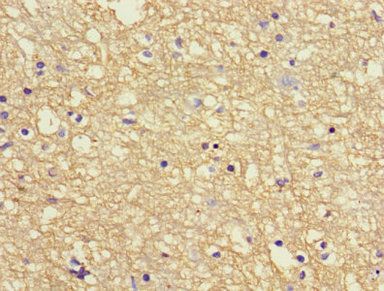 Amyloid beta A4 protein antibody