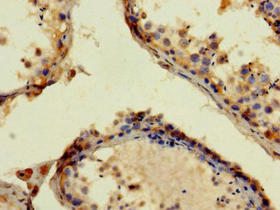 APP Antibody