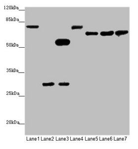 Amyloid beta A4 protein antibody