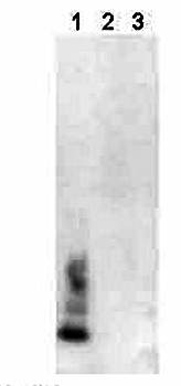 Amyloid, beta (1-40) C-Terminal Antibody