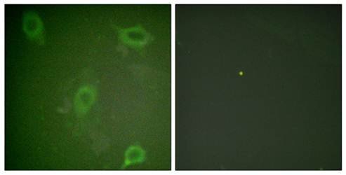 Amyloid β A4 (Phospho-Thr743/668) Antibody
