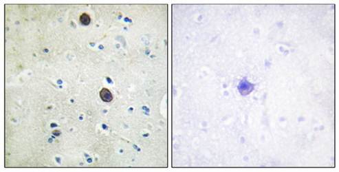 Amyloid beta A4 (phospho-Thr743/668) antibody