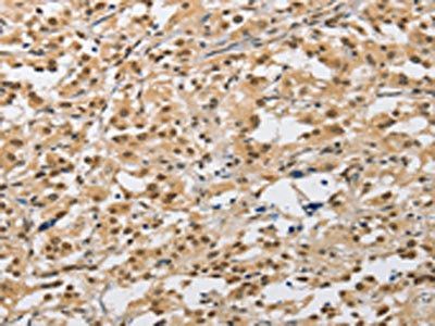 AMZ2 Antibody