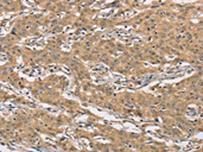 AMZ2 Antibody