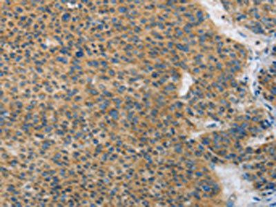 ANAPC13 Antibody