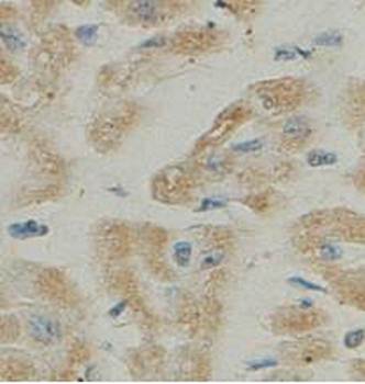 ANAPC2 Rabbit Polyclonal Antibody