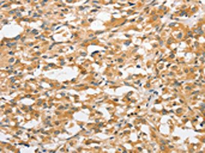 ANAPC5 Antibody