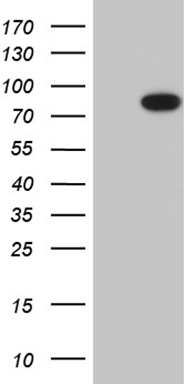 Androgen Receptor Antibody