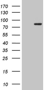 Androgen Receptor Antibody