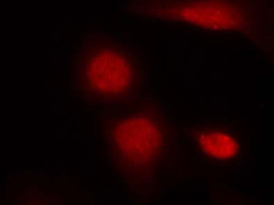 Androgen Receptor (Phospho-Ser213) Antibody