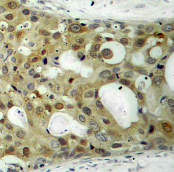 Androgen Receptor (Phospho-Ser650) Antibody