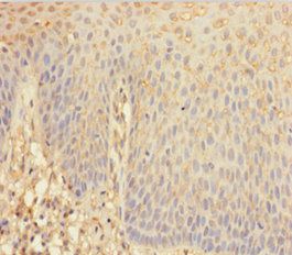 ANGPTL2 Antibody