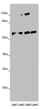 Angiopoietin 2 antibody