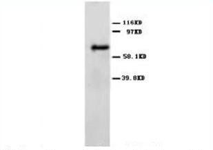 Anti-Angiopoietin 2/ANGPT2 Antibody