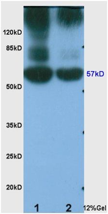 Angiopoietin 3/4 antibody