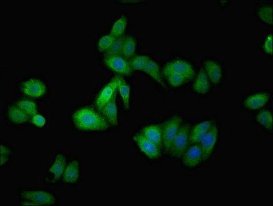 AGT Antibody